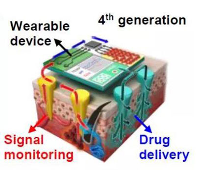 第四代透皮给药技术：在可穿戴设备的帮助下，用于患者定制治疗.jpg