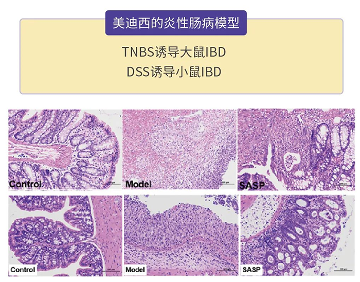 尊龙凯时人生就博官网登录,ag尊龙凯时，尊龙凯时的炎性肠病模型.png