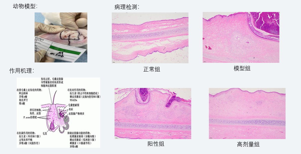 案例3：新西兰兔痤疮药效研究.jpg